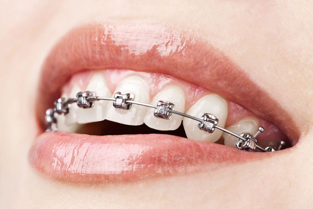 Causey Orthodontics